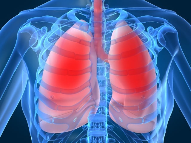 Hipertensão Pulmonar