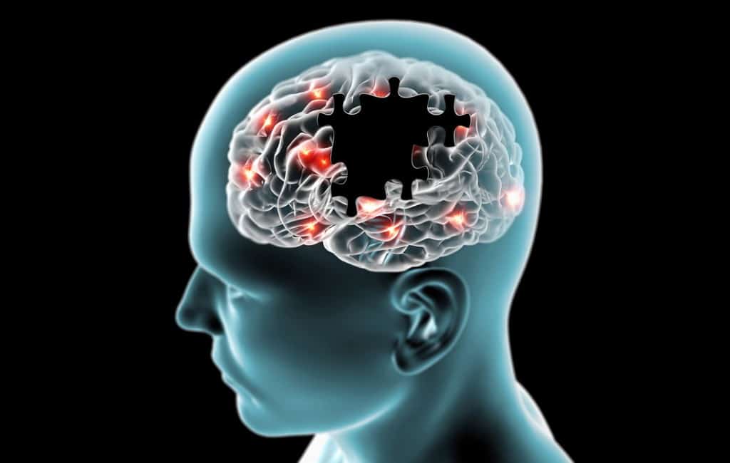 Principais Sintomas do Mal de Parkinson