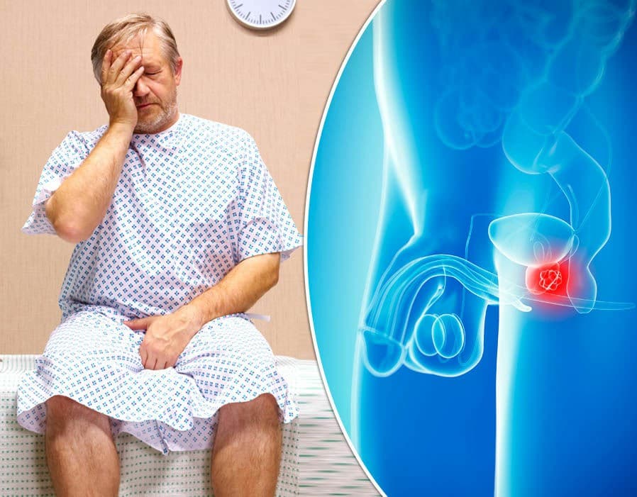 Os 6 Principais Sintomas do Câncer de Próstata