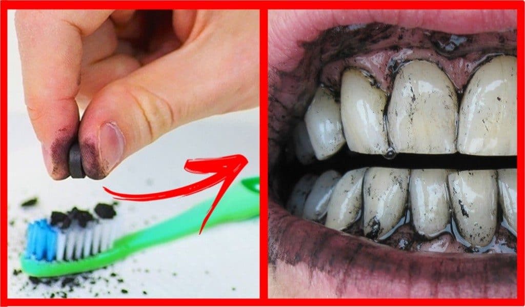 Como clarear os dentes em casa