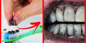 Como Clarear os Dentes em Casa