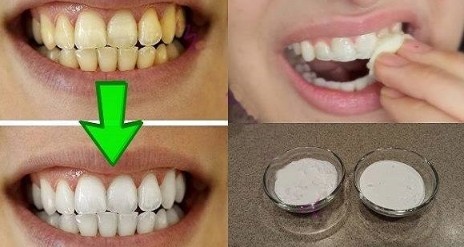 Clarear os Dentes em Casa